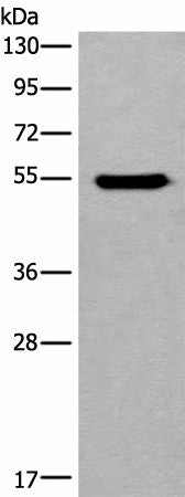 Anti-Human CYP11B2 Antibody - ABMIUM