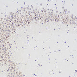 Immunohistochemistry analysis of paraffin-embedded mouse brain using CHAT Polyclonal Antibody at dilution of 1:300.
