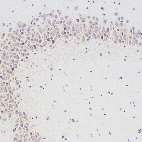 Immunohistochemistry analysis of paraffin-embedded mouse brain using CHAT Polyclonal Antibody at dilution of 1:300.