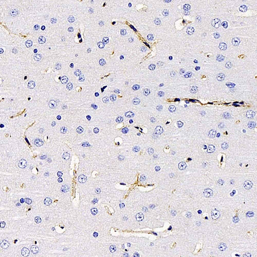 Immunohistochemistry analysis of paraffin-embedded rat brain using AQP4 Polyclonal Antibody at dilution of 1:400.