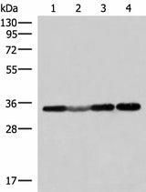 Western blot analysis of 293T and Hela cell Human fetal liver tissue lysates using ECH1 Polyclonal Antibody at dilution of 1:300