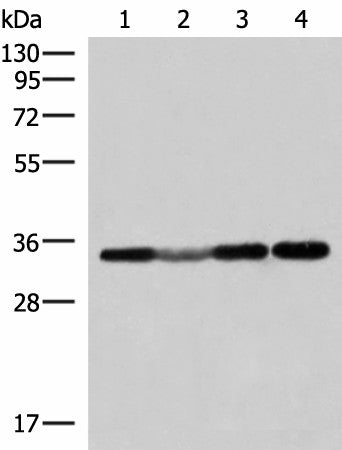 Western blot analysis of 293T and Hela cell Human fetal liver tissue lysates using ECH1 Polyclonal Antibody at dilution of 1:300