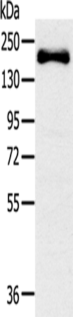 Anti-Human/Mouse/Rat SLIT2 Antibody - ABMIUM