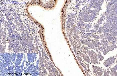 Anti-Human/Mouse/Rat COL1A1 Antibody [3C3]