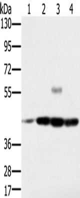 Anti-Human/Mouse/Rat PAICS Antibody - ABMIUM