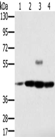 Anti-Human/Mouse/Rat PAICS Antibody - ABMIUM