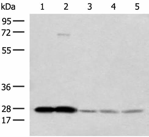 Western blot analysis of Human cerebella tissue Human cerebrum tissue Human skin tissue NIH/3T3 cell SKOV3 cell lysates using OVOL2 Polyclonal Antibody at dilution of 1:350
