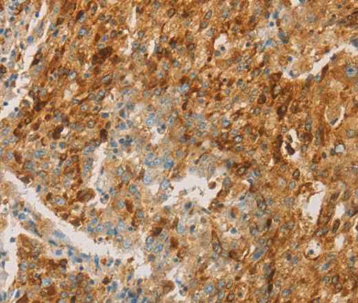 Anti-Human CEACAM8 Antibody
