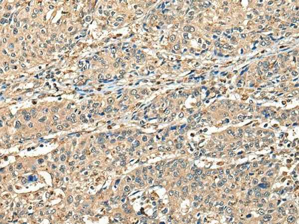 Anti-Human/Mouse CCDC112 Antibody
