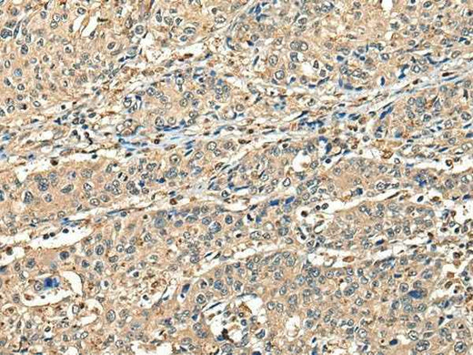 Anti-Human/Mouse CCDC112 Antibody