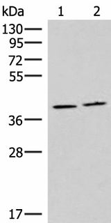 Western blot analysis of Human placenta tissue and Human fetal brain tissue lysates using HMGCLL1 Polyclonal Antibody at dilution of 1:1000