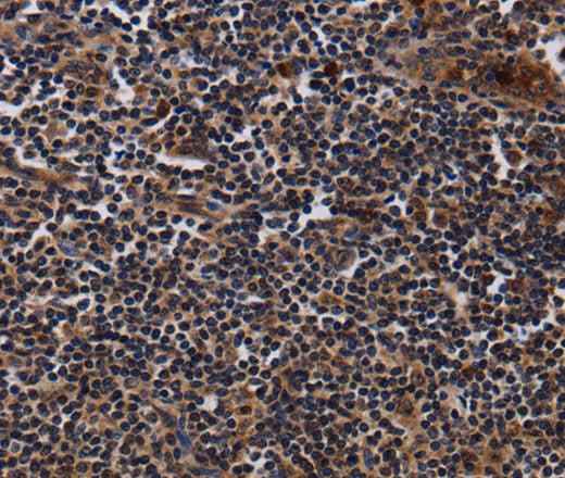 Anti-Human/Mouse/Rat NTMT1 Antibody