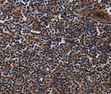Anti-Human/Mouse/Rat NTMT1 Antibody - ABMIUM