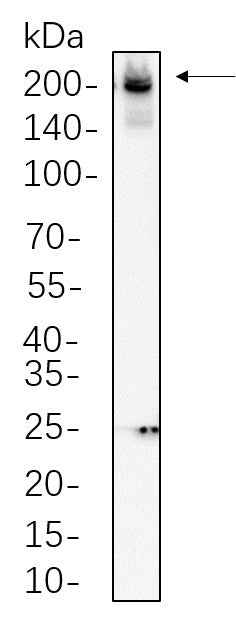 Anti-Human Collagen II Antibody [B1102] - ABMIUM