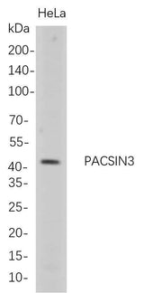 Anti-Human PACSIN3 Antibody [B710]
