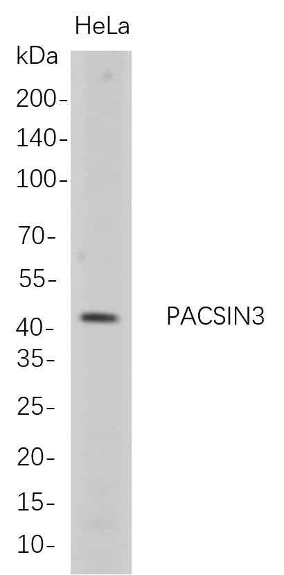 Anti-Human PACSIN3 Antibody [B710] - ABMIUM