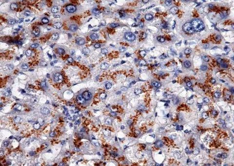 Anti-Human APOH Antibody [B318] - ABMIUM