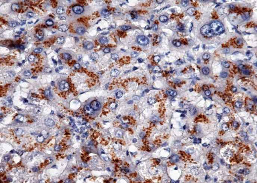 Anti-Human APOH Antibody [B318] - ABMIUM