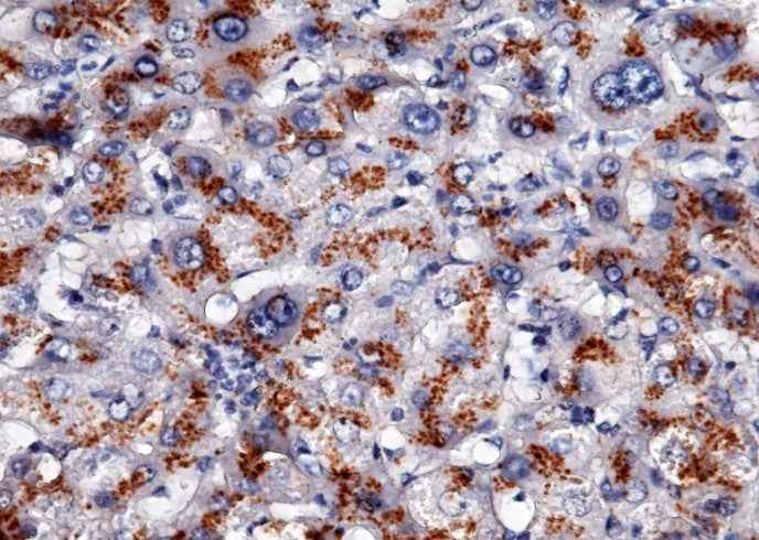 Anti-Human APOH Antibody [B318]