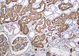 Anti-Human/Mouse/Rat AQP1 Antibody [B1170]