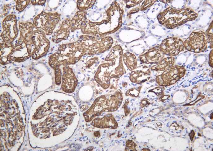 Anti-Human/Mouse/Rat AQP1 Antibody [B1170]