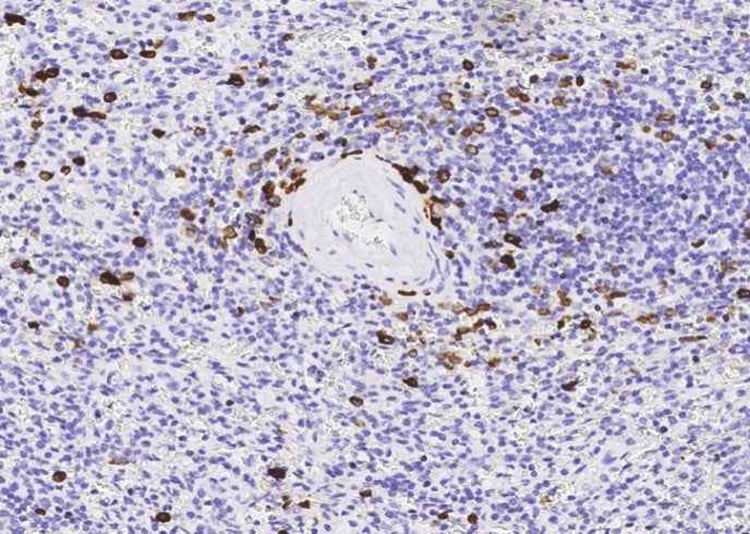 Anti-Human MZB1 Antibody [B208] - ABMIUM