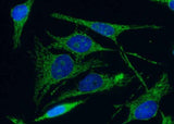 Anti-Human C1QBP Antibody [A887] - ABMIUM