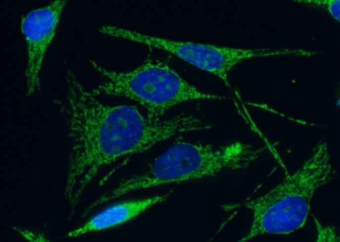 Anti-Human C1QBP Antibody [A887] - ABMIUM