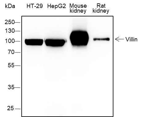 Anti-Human/Rat/Mouse Villin Antibody [A387]