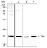 Anti-Human/Rat/Mouse BAG2 Antibody [A465]