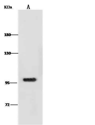 Anti-Human ANO1 Antibody [B231] - ABMIUM