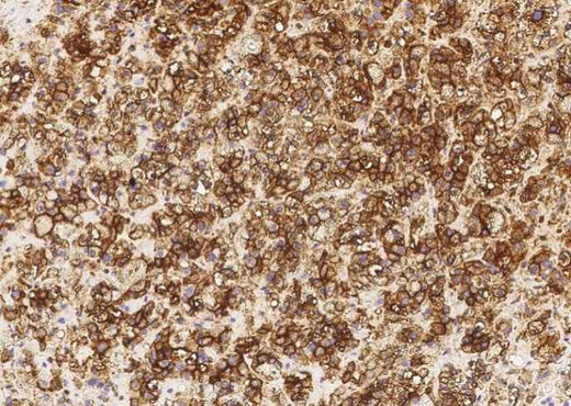 Anti-Human ALPL Antibody [A1202] - ABMIUM
