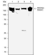 Anti-Human/Rat/Mouse ROCK2+ROCK1 Antibody [A626]