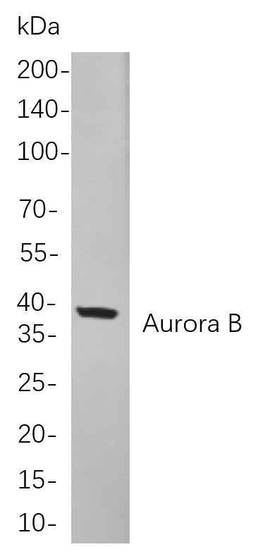 Anti-Human Aurora B Antibody [B849] - ABMIUM