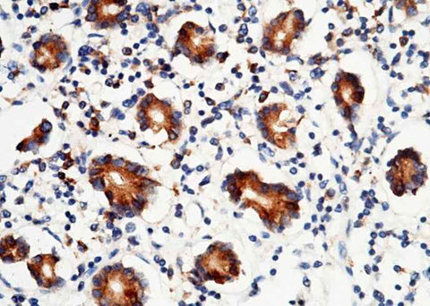 Anti-Human P4HB Antibody [A1039] - ABMIUM