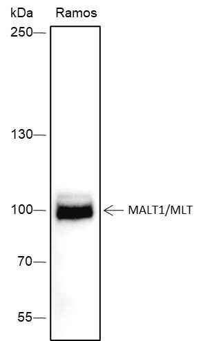 Anti-Human MALT1/MLT Antibody [A294] - ABMIUM