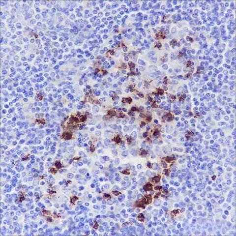 Anti-Human PD1 Antibody [A115] - ABMIUM