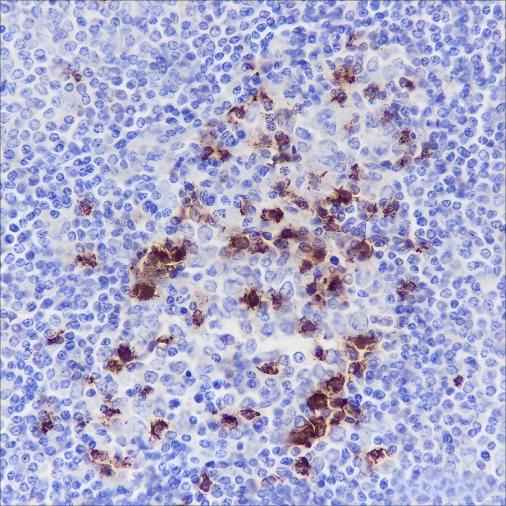 Anti-Human PD1 Antibody [A115] - ABMIUM