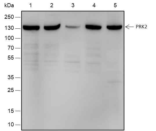 Anti-Human/Rat/Mouse PRK2 Antibody [A515]