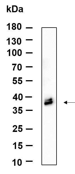 Anti-Human/Mouse/Rat ApoE Antibody [B888] - ABMIUM