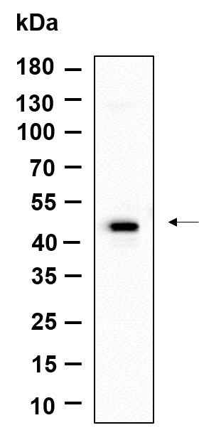 Anti-Human/Mouse GPR182 Antibody [B965] - ABMIUM