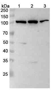 Anti-ABCB6 Polyclonal Antibody