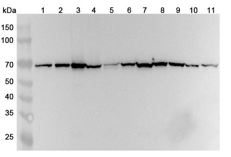 Anti-ATIC Polyclonal Antibody binds to Human ATIC Recombinant Protein, N-His in WB Assay