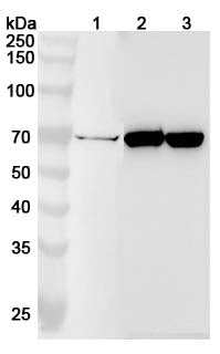 Anti-BCHE Polyclonal Antibody binds to Recombinant Human BCHE, N-His in WB Assay