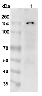 Anti-Human ANO1 Polyclonal Antibody binds to Recombinant Human ANO1 Protein, N-His in WB Assay