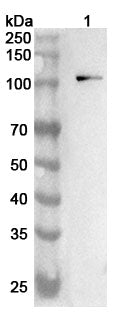 Anti-Human CDH3 Polyclonal Antibody binds to Human CDH3 Recombinant Protein, N-His in WB Assay