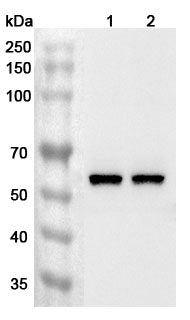 Anti-Human DMAP1 Polyclonal Antibody binds to Recombinant Human DMAP1 Protein, N-His in WB Assay