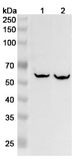Anti-Human FTCD Polyclonal Antibody binds to Recombinant Human FTCD Protein, N-His in WB Assay