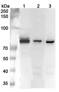 Anti-Human PEX5 Polyclonal Antibody binds to Recombinant Human PEX5 Protein, N-His in WB Assay