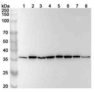 Anti-Human RPLP0 Polyclonal Antibody